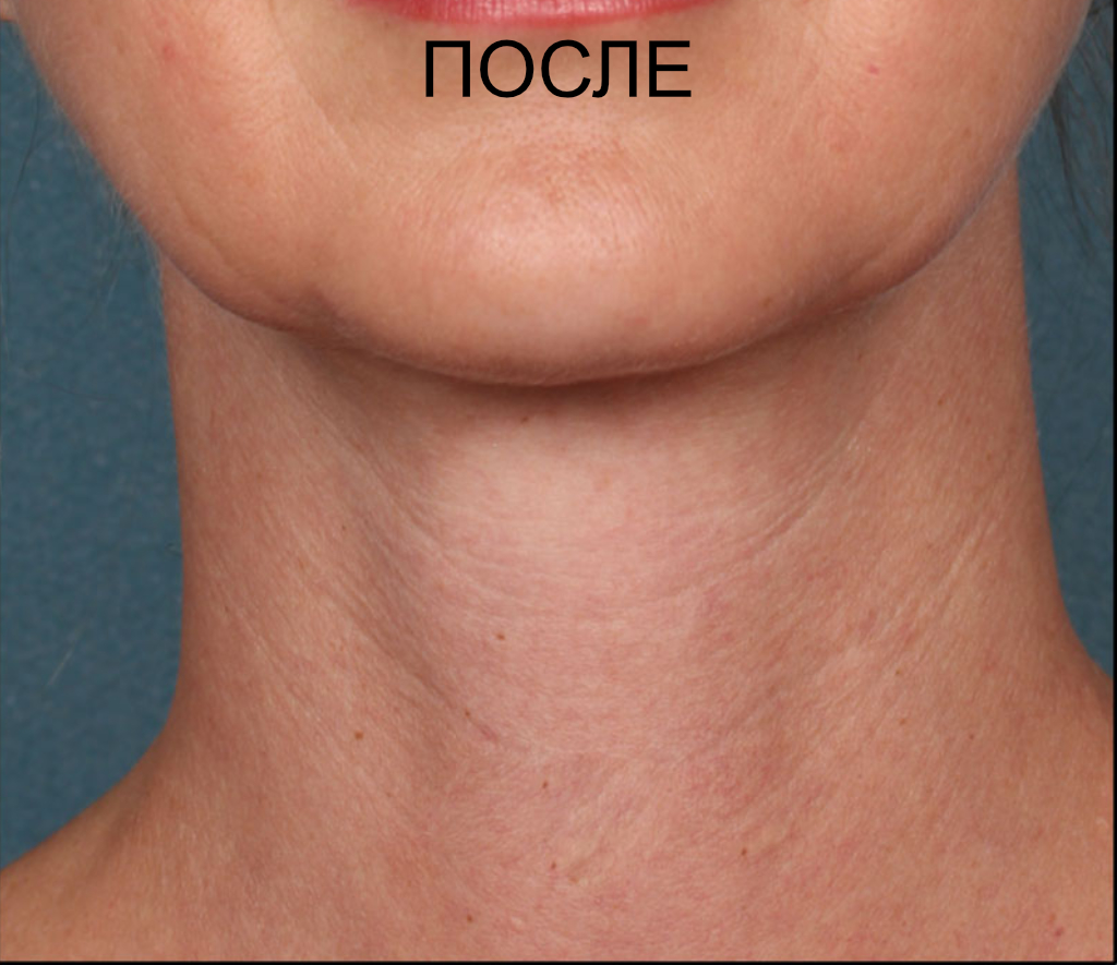 До и после