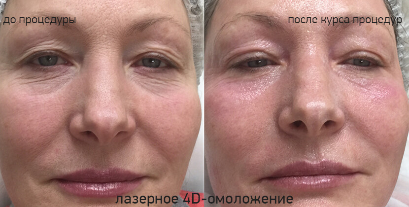 До и после