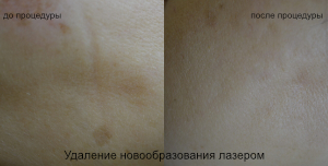 До и после