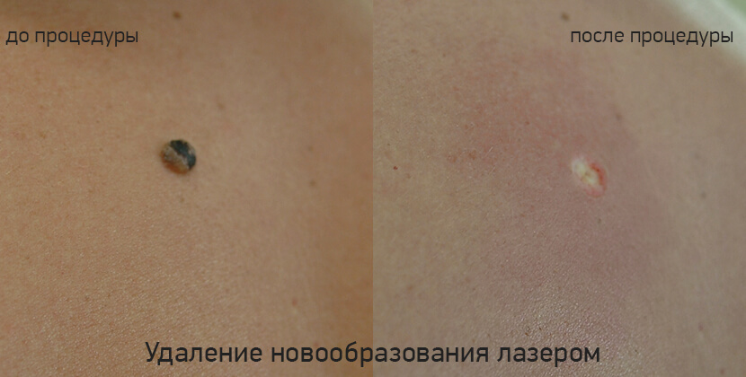 До и после