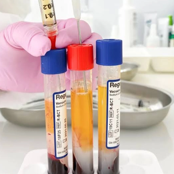 PRP 1